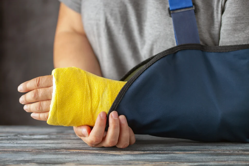 Close-up of a person's arm in a blue sling with a yellow bandage on the hand.
