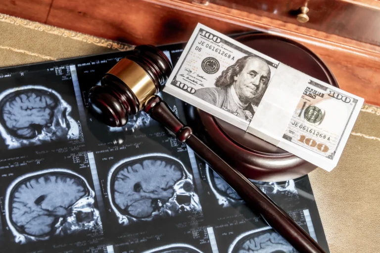 Wooden judge gavel, stack of hundred-dollar bills, and brain MRI scans on a desk.